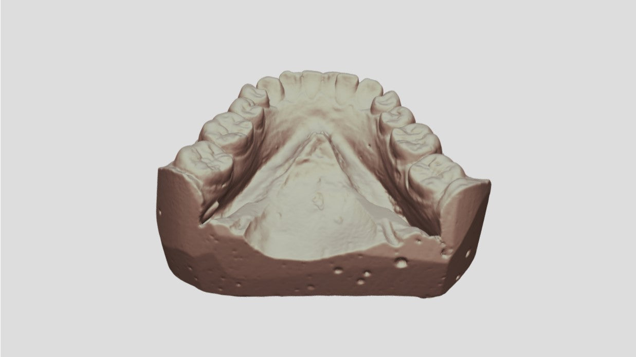 Dental Model(scanned by Revopoint MINI)